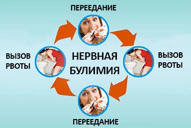 Лечение булимии в Белой Калитве
